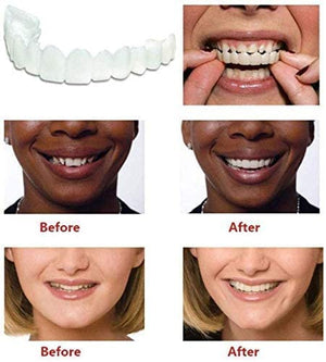 Dentures On Demand-Self Customized Home Fit Removable Dentures Aleck