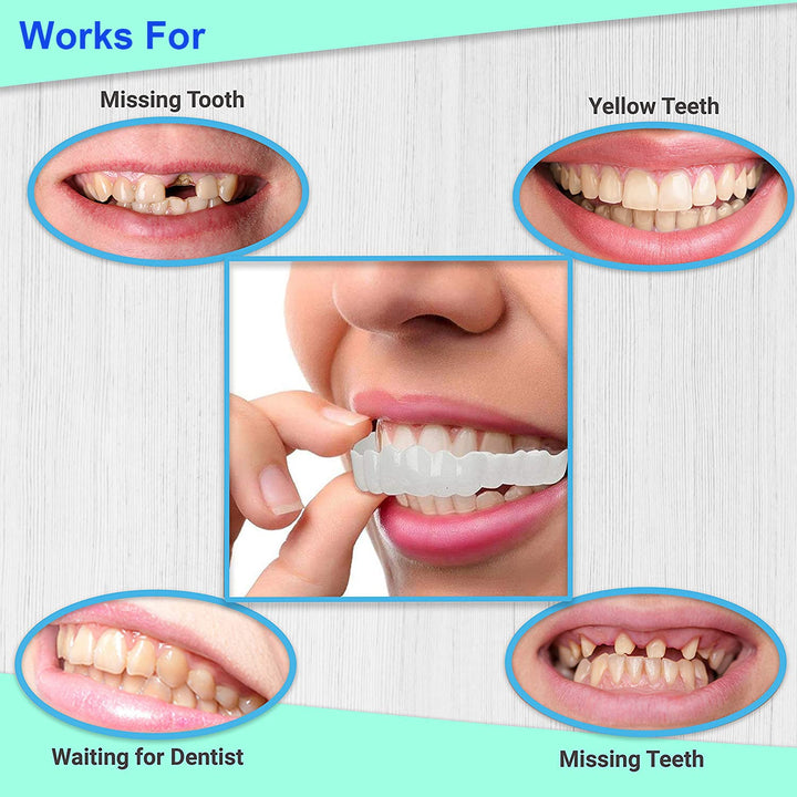 Snap on Smile Veneers - Smilo™ Aleck