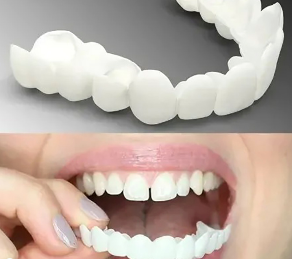 True Smile Veneers Teeth Covers-Natural white (1Pair-Upper & Lower) Aleck