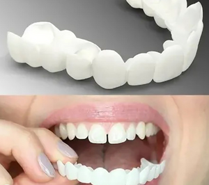 True Smile Veneers Teeth Covers-Natural white (1Pair-Upper & Lower) Aleck