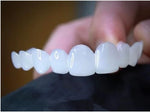 Teeth veneers Instant Cosmetic Veneers (Upper & Lower) A Listveneers