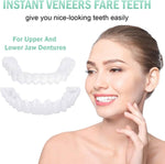 Teeth veneers Instant Cosmetic Veneers (Upper & Lower) A Listveneers