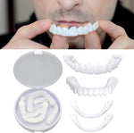 Teeth veneers Instant Cosmetic Veneers (Upper & Lower) A Listveneers