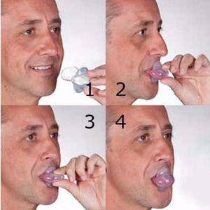 Apnea Tongue Stabilizing Device Aleck