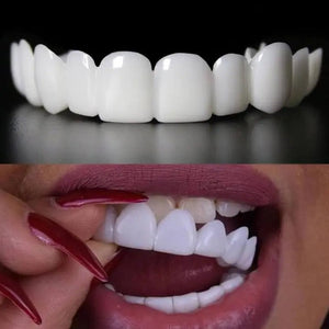 Pair of The White Bright's Snap on Veneers instant smile Aleck